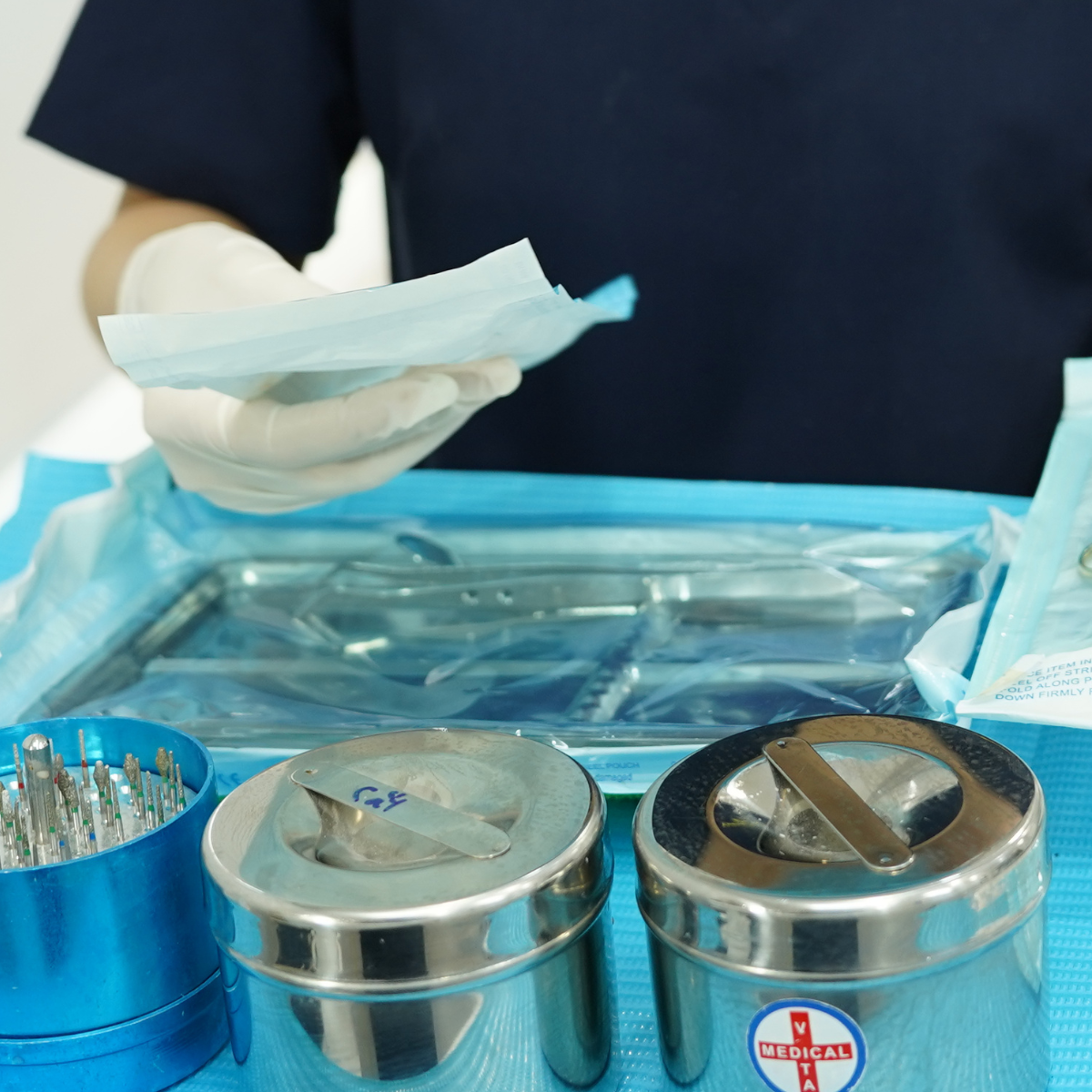 Cạo vôi răng là gì?