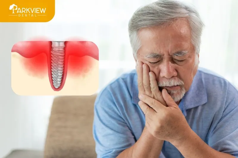 Trồng răng implant bao lâu thì ăn được