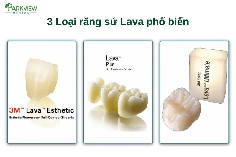 3 Loại sứ Lava phổ biến