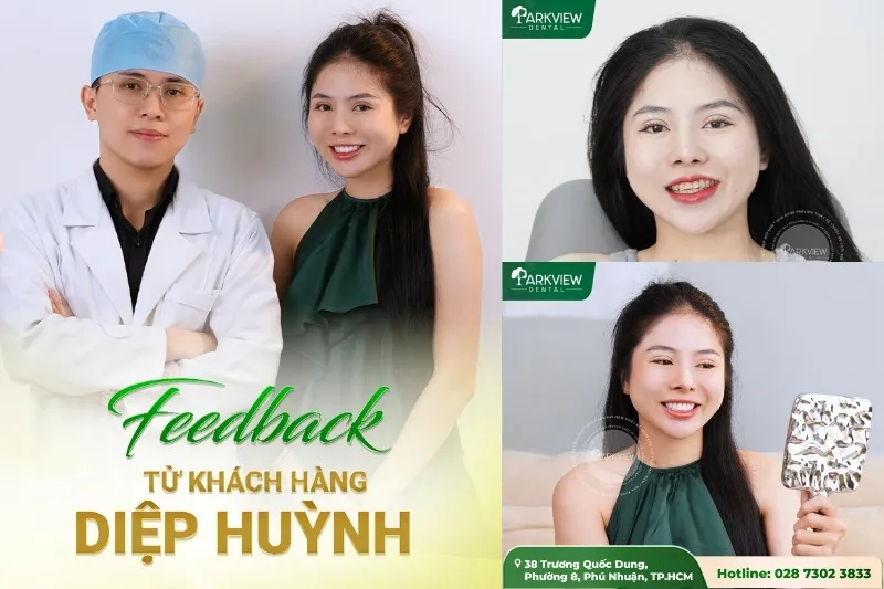 Feedback của khách hàng khi làm răng sứ tại Nha khoa Parkview