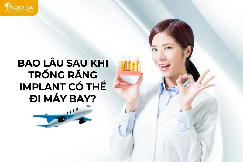 Bao lâu sau khi trồng răng Implant có thể đi máy bay?