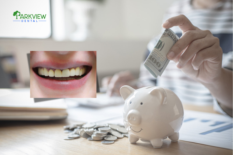 Bọc răng sứ 500K giúp tiết kiệm chi phí cho người có ngân sách hạn chế