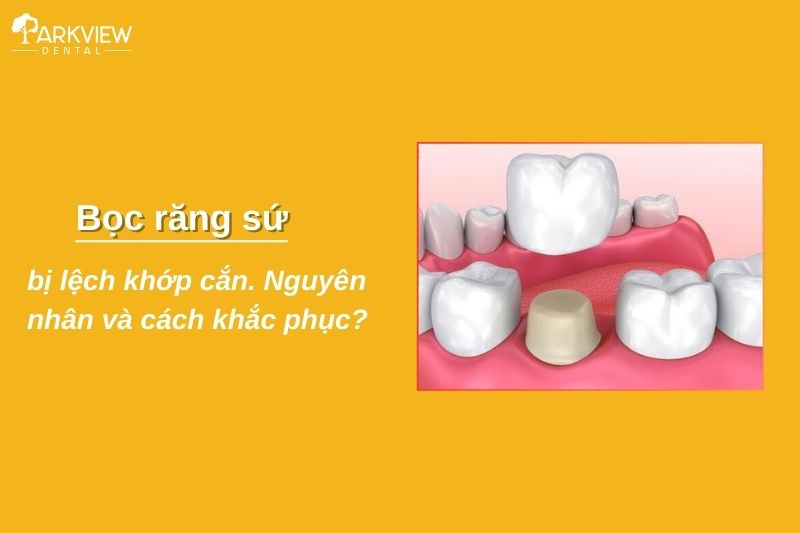 bọc răng sứ bị lệch khớp cắn