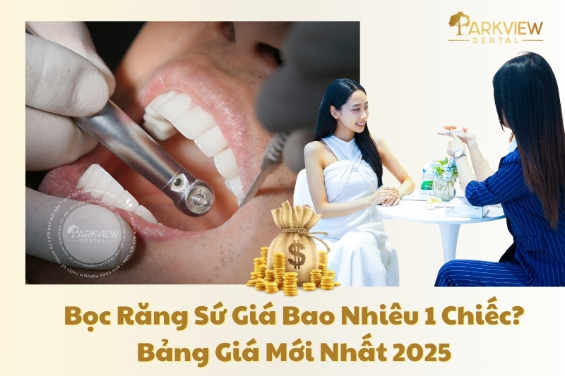 bọc răng sứ giá bao nhiêu 1 chiếc