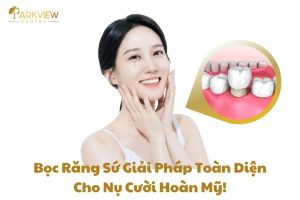 bọc răng sứ