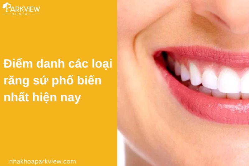 các loại răng sứ