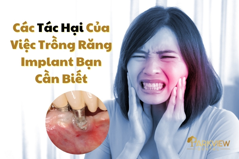 tác hại của việc trồng răng implant