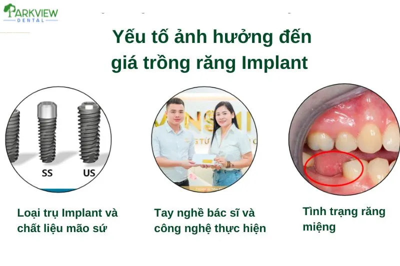 Các yếu tố ảnh hưởng đến giá trồng răng Implant