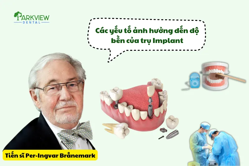 Các yếu tố quyết định trồng răng Implant được bao lâu