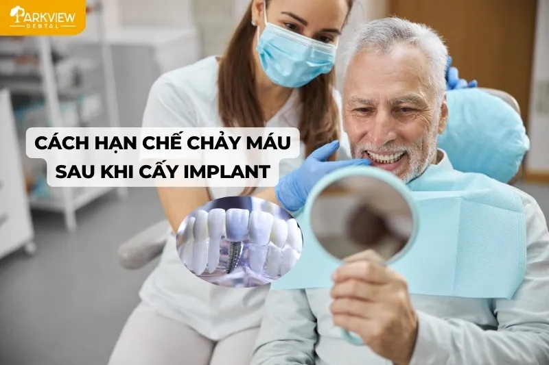 Cách hạn chế chảy máu sau khi cấy Implant