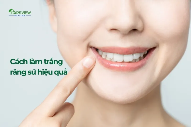 Cách làm trắng răng sứ hiệu quả