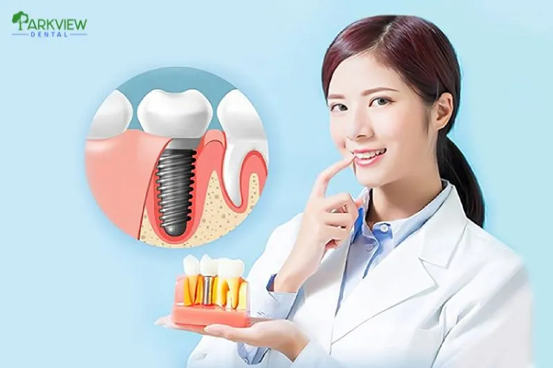 Chi phí trồng răng Implant tại TPHCM