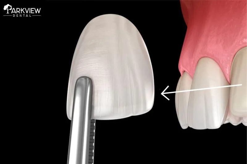 Có thể tái sử dụng răng sứ đã tháo không?