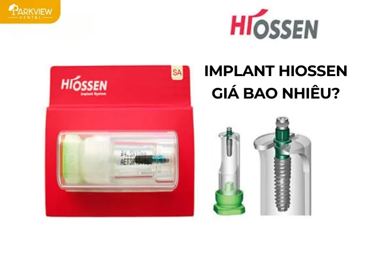 Implant Hiossen giá bao nhiêu?