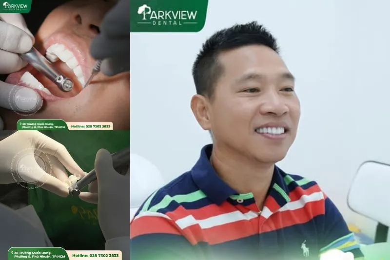Hình ảnh khách hàng trồng răng Implant tại Nha khoa Parkview
