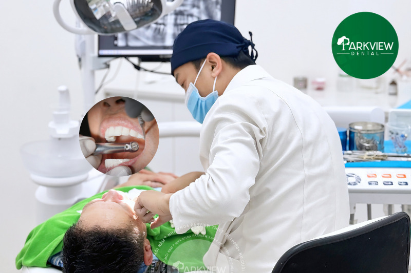 Làm răng sứ an toàn và chất lượng với đội ngũ bác sĩ trên 10 năm kinh nghiệm tại Parkview
