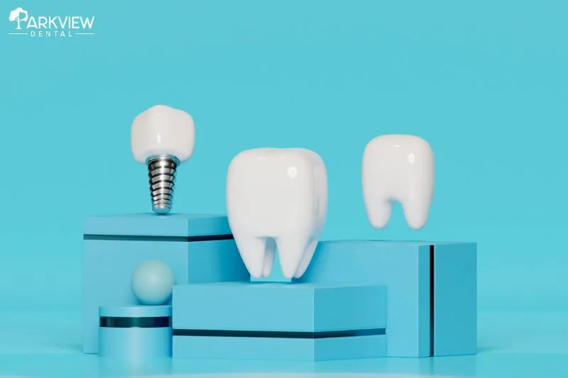 Những lý do khiến trồng răng Implant mắc hơn các phương pháp khác