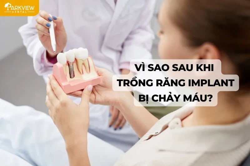 Lý do sau khi trồng răng Implant bị chảy máu