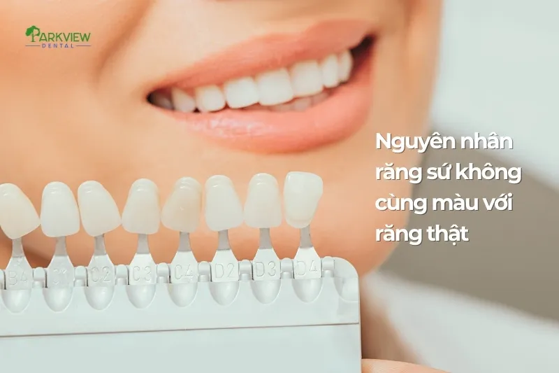 Nguyên nhân răng sứ không cùng màu với răng thật