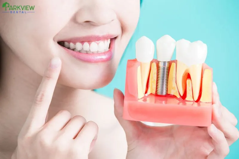 Những điều kiện phù hợp để cấy ghép Implant