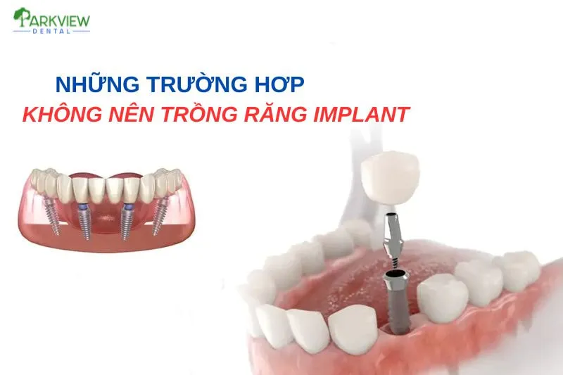 Những trường hợp không nên trồng răng Implant