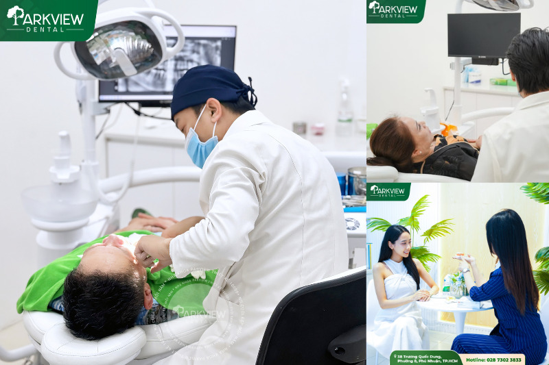 Quy Trình Làm Răng Sứ Uy Tín Tại Nha Khoa Parkview