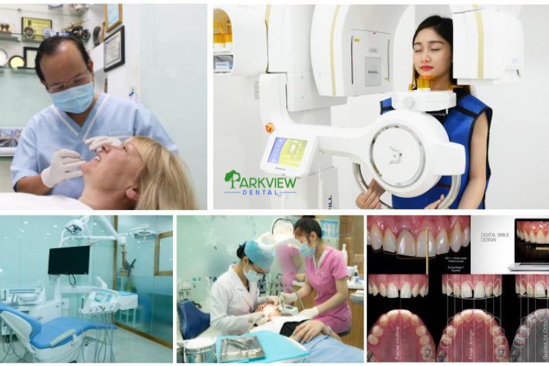 Răng sứ 800K - Giá cả và chất lượng có xứng đáng?