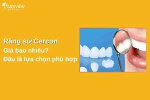 răng sứ cercon giá bao nhiêu