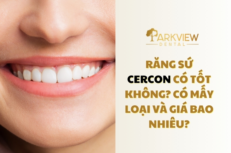 răng sứ Cercon