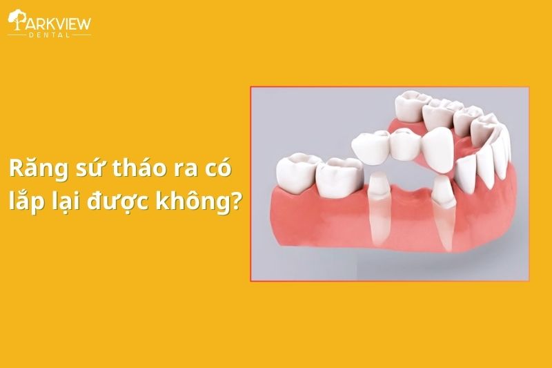 răng sứ tháo ra có lắp lại được không