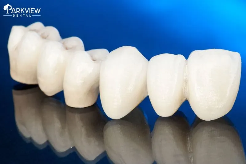 Răng sứ Zirconia là một loại răng sứ cao cấp được làm từ Zirconium Dioxide