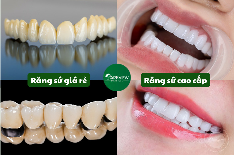 Sự khác biệt về thẩm mỹ của răng sứ giá rẻ & răng sứ cao cấp