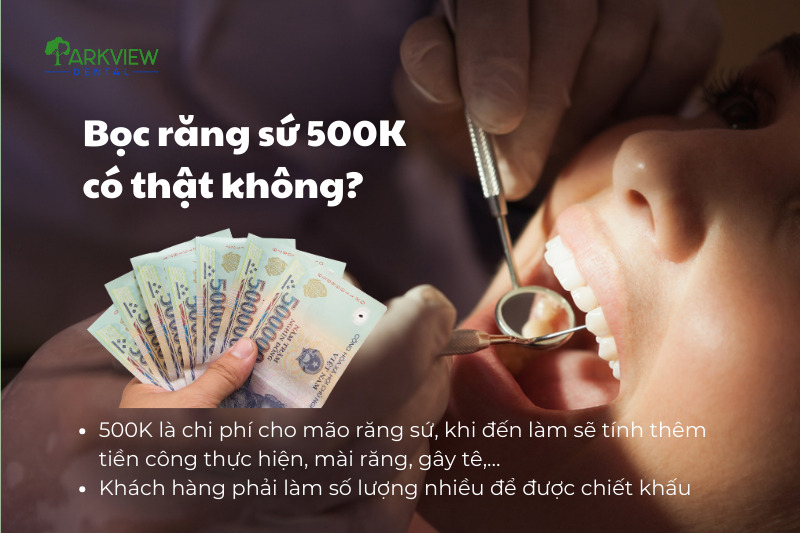 Sự thật đằng sau dịch vụ bọc răng sứ 500K