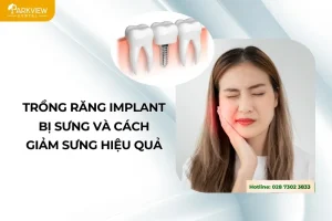 trồng răng implant bị sưng