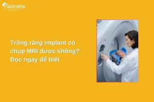 trồng răng implant có chụp mri được không