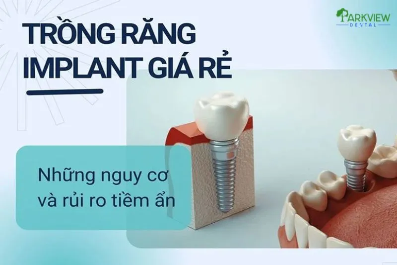 Trồng răng Implant giá rẻ có an toàn không?