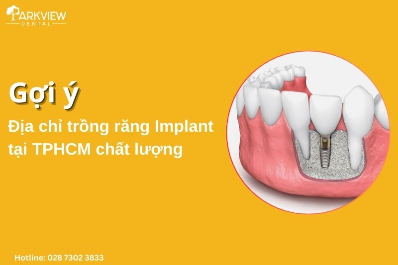 trồng răng implant tại tphcm