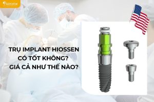 trụ implant hiossen