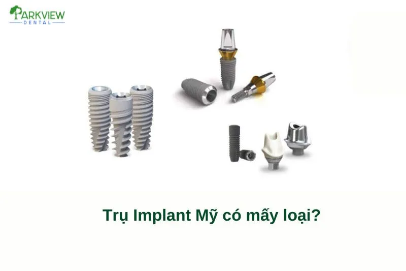 Trụ Implant Mỹ có những loại nào?