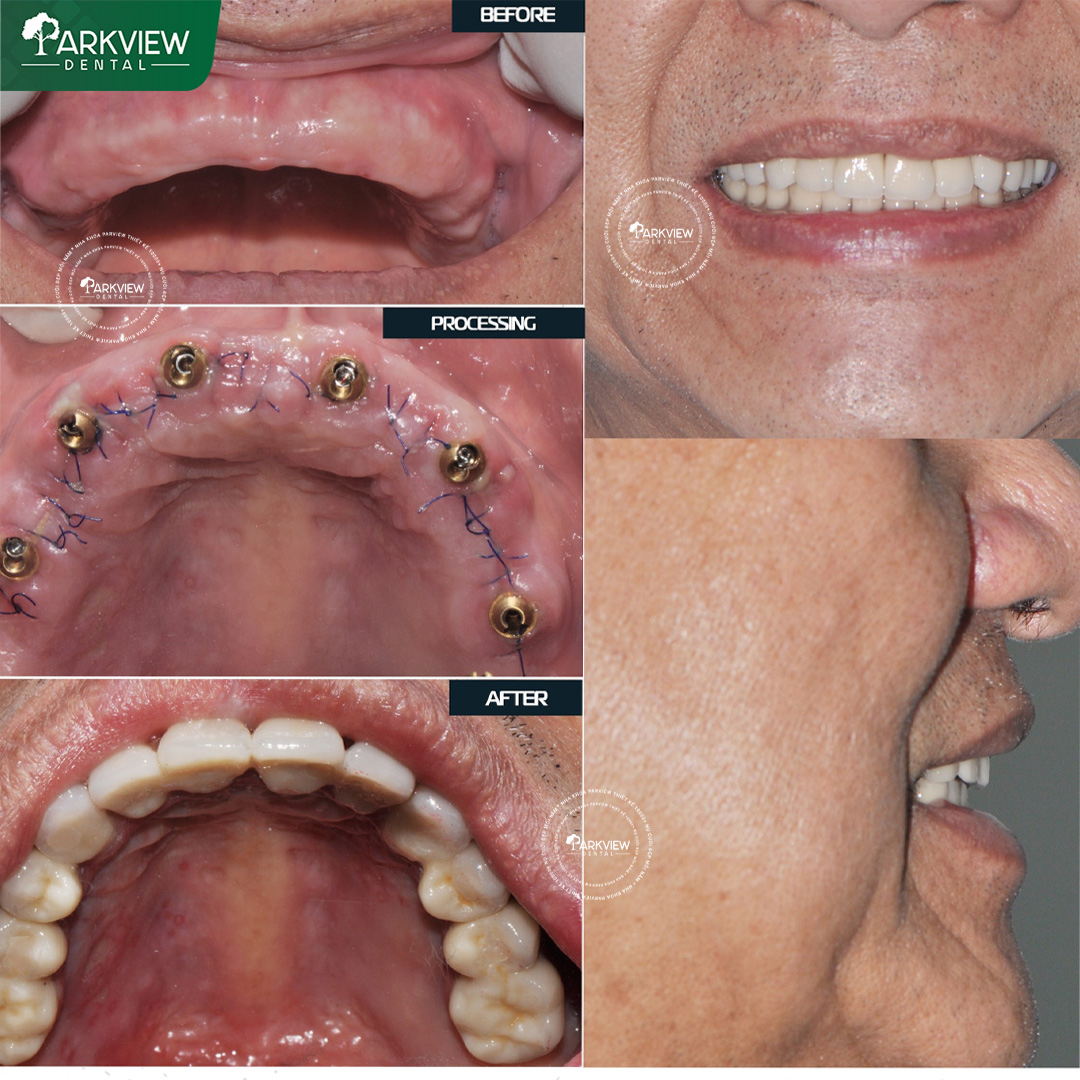 Khách hàng tại Nha Khoa Parkview